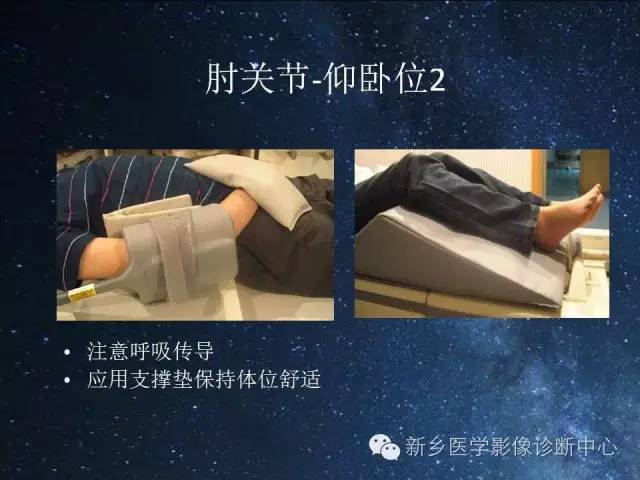 【PPT】骨关节MR扫描及注意事项
