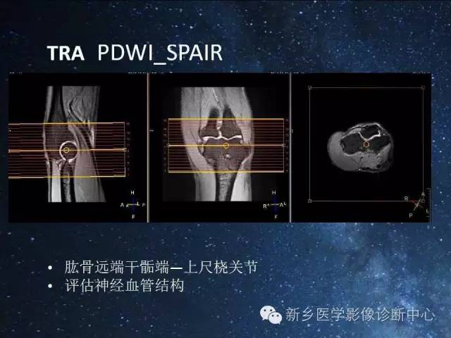 【PPT】骨关节MR扫描及注意事项