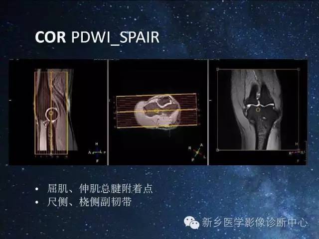【PPT】骨关节MR扫描及注意事项