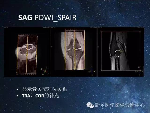 【PPT】骨关节MR扫描及注意事项