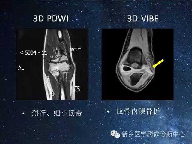 【PPT】骨关节MR扫描及注意事项