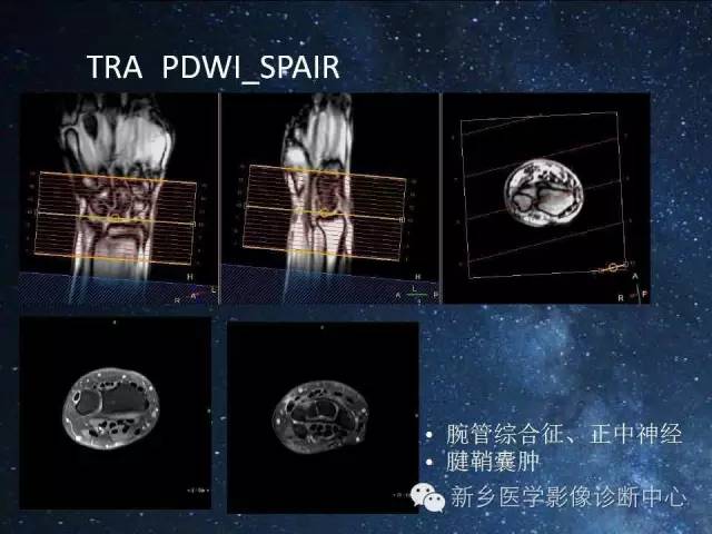 【PPT】骨关节MR扫描及注意事项