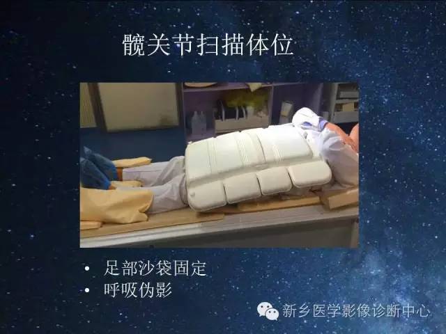 【PPT】骨关节MR扫描及注意事项
