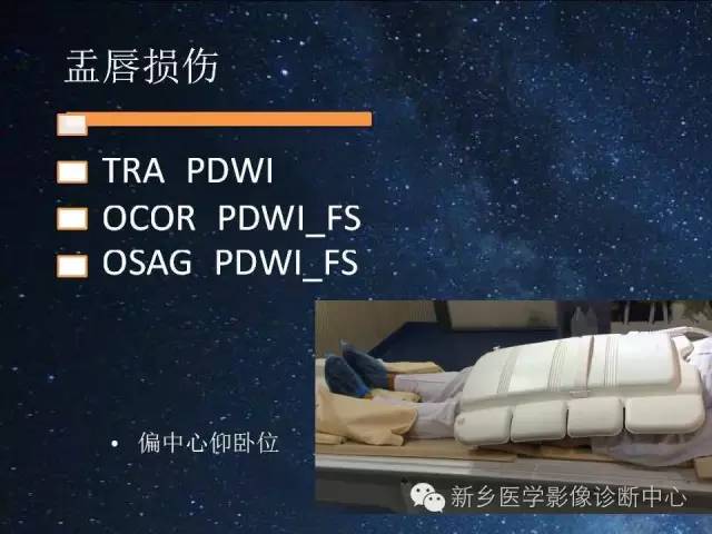 【PPT】骨关节MR扫描及注意事项
