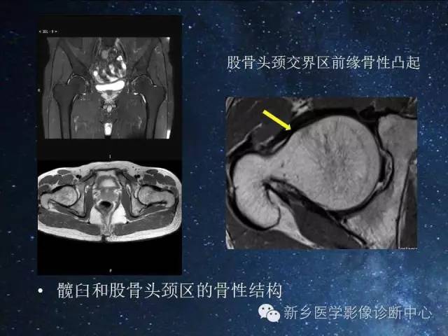 【PPT】骨关节MR扫描及注意事项