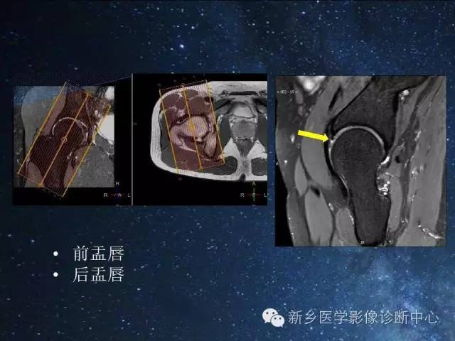 【PPT】骨关节MR扫描及注意事项