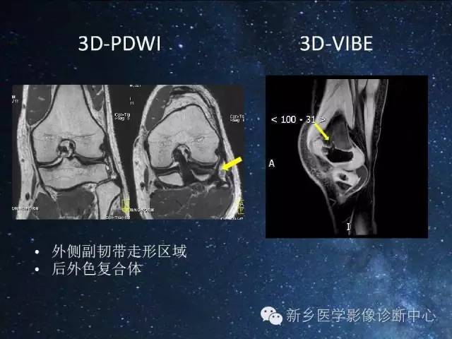 【PPT】骨关节MR扫描及注意事项