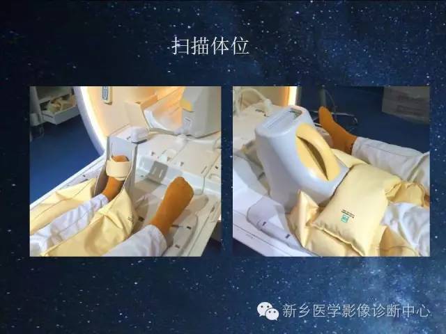 【PPT】骨关节MR扫描及注意事项