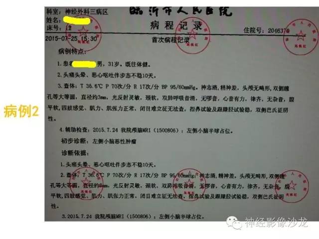 【病例】恶性脑膜瘤一例MR影像表现