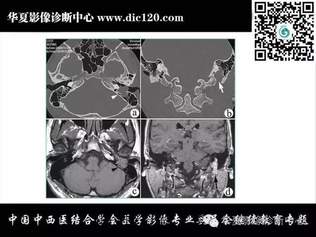 【PPT】耳部疾病的影像诊断和鉴别