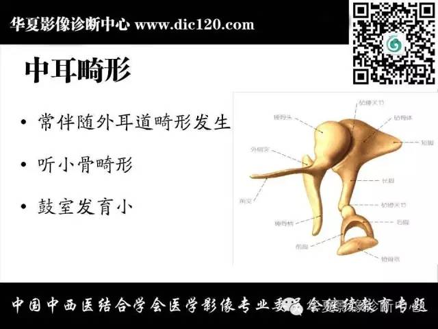 【PPT】耳部疾病的影像诊断和鉴别