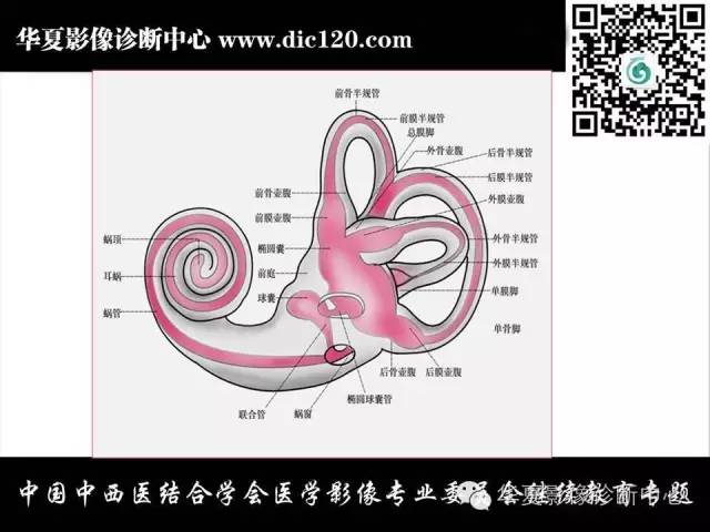 【PPT】耳部疾病的影像诊断和鉴别