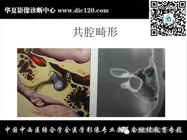 【PPT】耳部疾病的影像诊断和鉴别