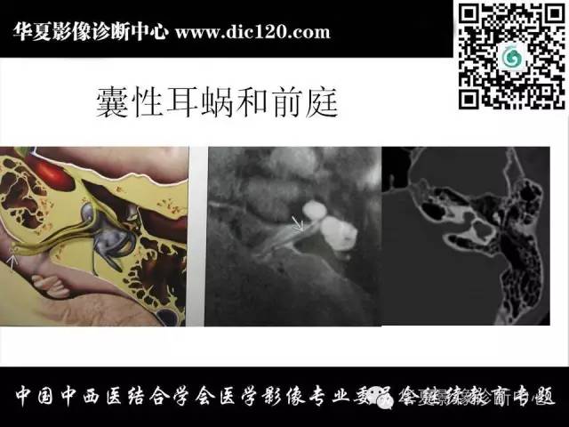 【PPT】耳部疾病的影像诊断和鉴别