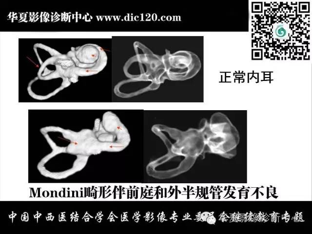 【PPT】耳部疾病的影像诊断和鉴别