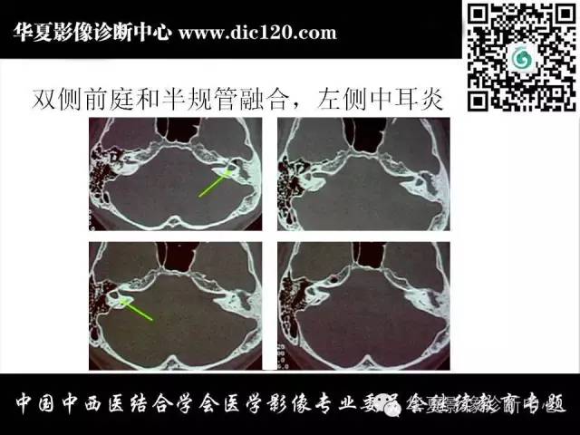 【PPT】耳部疾病的影像诊断和鉴别