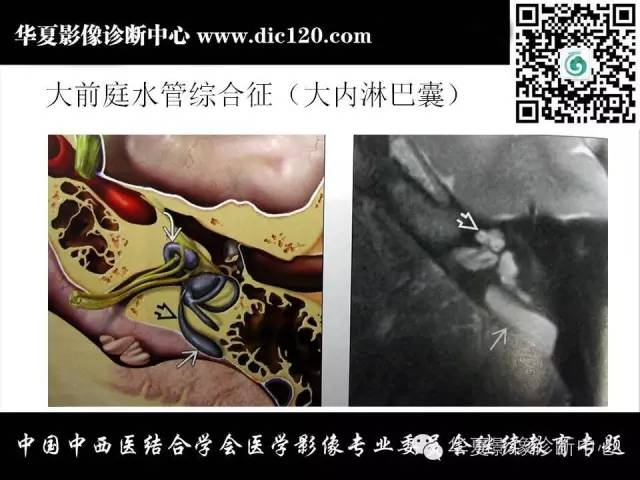 【PPT】耳部疾病的影像诊断和鉴别