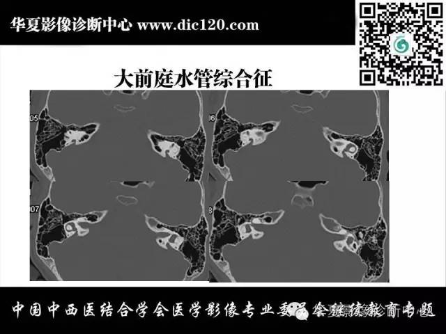 【PPT】耳部疾病的影像诊断和鉴别