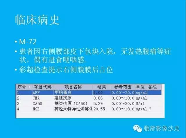 【病例】十二指肠间质瘤1例CT影像表现