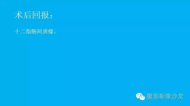 【病例】十二指肠间质瘤1例CT影像表现 【病例】十二指肠间质瘤1例CT影像表现