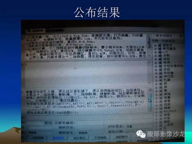 【病例】胰腺实性假乳头状瘤1例CT影像表现 【病例】胰腺实性假乳头状瘤1例CT影像表现