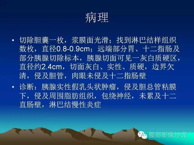 【病例】胰腺实性假乳头状瘤1例CT影像表现 【病例】胰腺实性假乳头状瘤1例CT影像表现