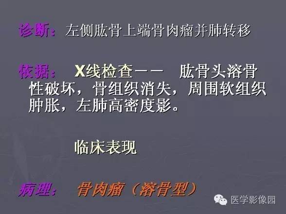 【PPT】骨肉瘤的X线诊断
