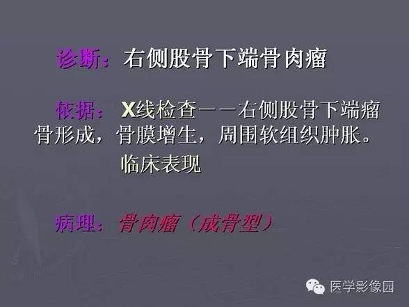 【PPT】骨肉瘤的X线诊断