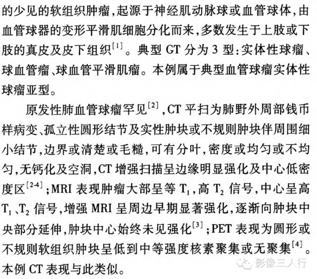 【病例】原发性肺血管球瘤一例CT影像表现
