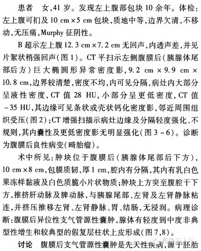 【病例】腹膜后异位支气管源性囊肿一例 【病例】腹膜后异位支气管源性囊肿一例