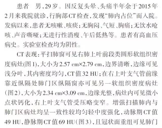 【病例】双原发性右肺典型类癌一例