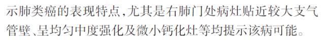 【病例】双原发性右肺典型类癌一例