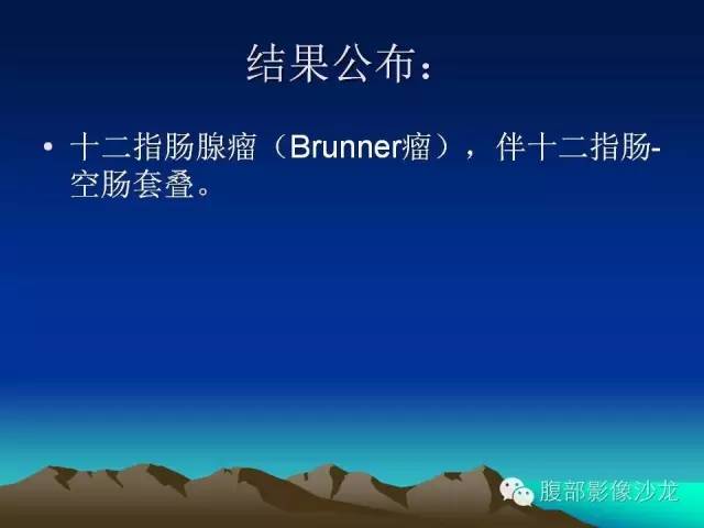 【病例】十二指肠腺瘤1例CT影像表现