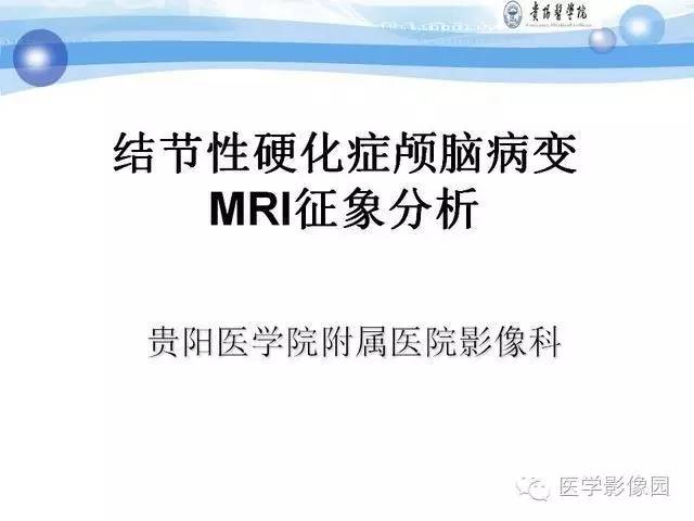 【PPT】 结节性硬化症颅脑病变MRI征象分析