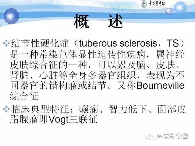 【PPT】 结节性硬化症颅脑病变MRI征象分析