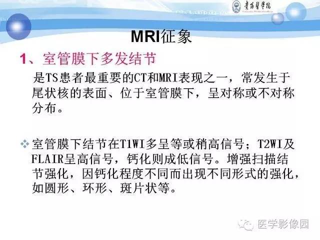 【PPT】 结节性硬化症颅脑病变MRI征象分析