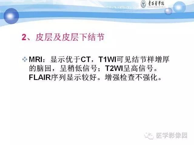 【PPT】 结节性硬化症颅脑病变MRI征象分析