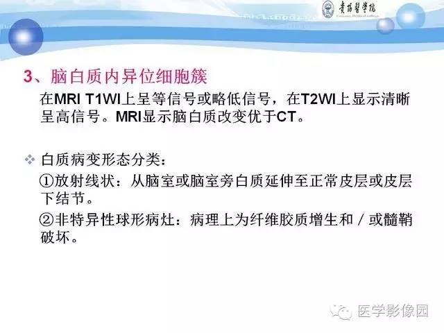 【PPT】 结节性硬化症颅脑病变MRI征象分析