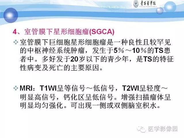 【PPT】 结节性硬化症颅脑病变MRI征象分析
