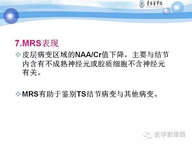 【PPT】 结节性硬化症颅脑病变MRI征象分析