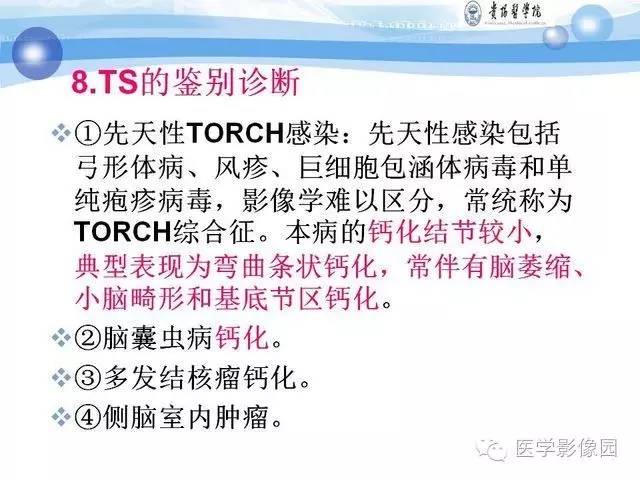 【PPT】 结节性硬化症颅脑病变MRI征象分析