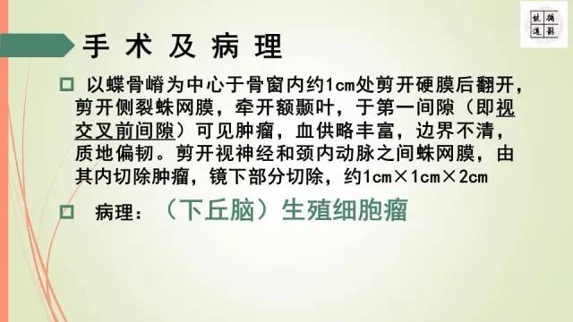 【病例】下丘脑生殖细胞瘤1例MR影像表现