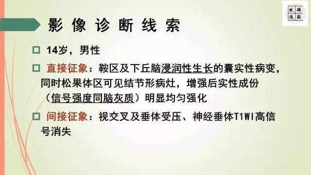【病例】下丘脑生殖细胞瘤1例MR影像表现