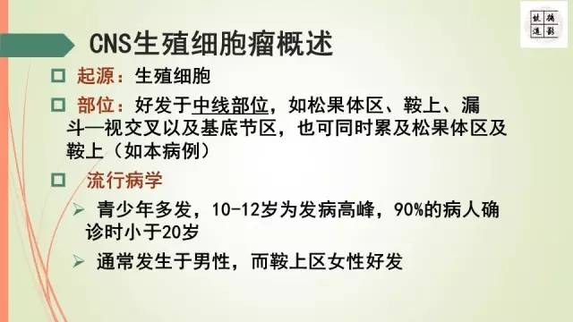 【病例】下丘脑生殖细胞瘤1例MR影像表现
