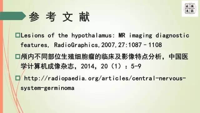【病例】下丘脑生殖细胞瘤1例MR影像表现