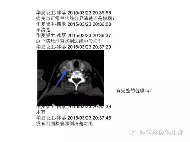 甲状腺腺瘤与甲状腺癌的鉴别
