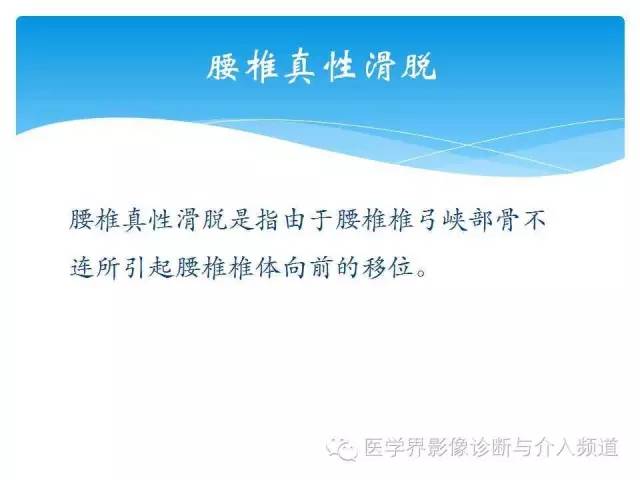 一眼看穿腰椎真性or假性滑脱