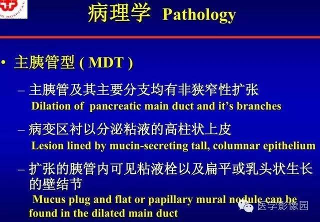 【PPT】胰腺少、罕见病变