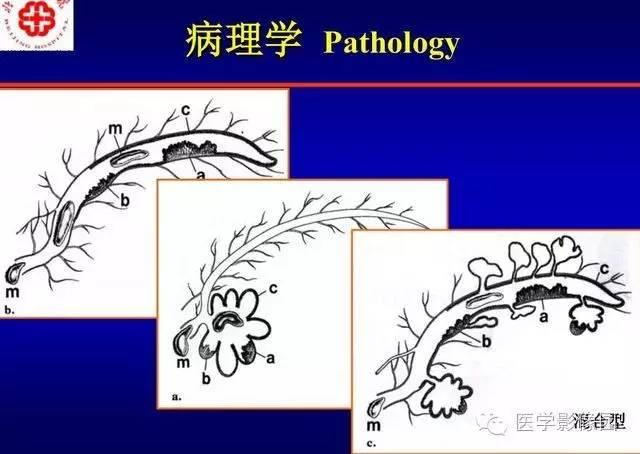 【PPT】胰腺少、罕见病变