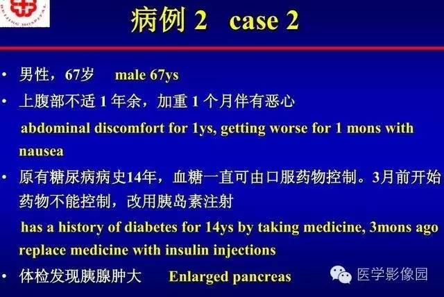 【PPT】胰腺少、罕见病变